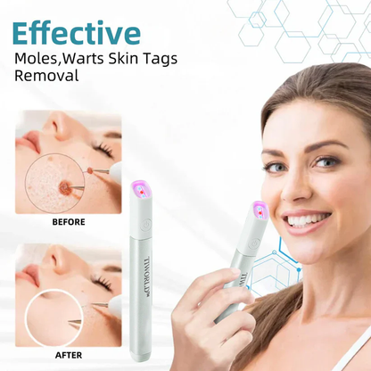 ✨Tiworld™ All-in-One CO₂ Laser Eraser Pen | Removes Moles, Warts, Skin Flaws & Pigmentation