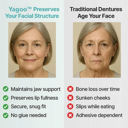 🌎Ends Today: 70% OFF! Yagoo™ Custom Custom-Fit Full Functional DenturesMake you more confident – Made in the USA & FDA-Certified