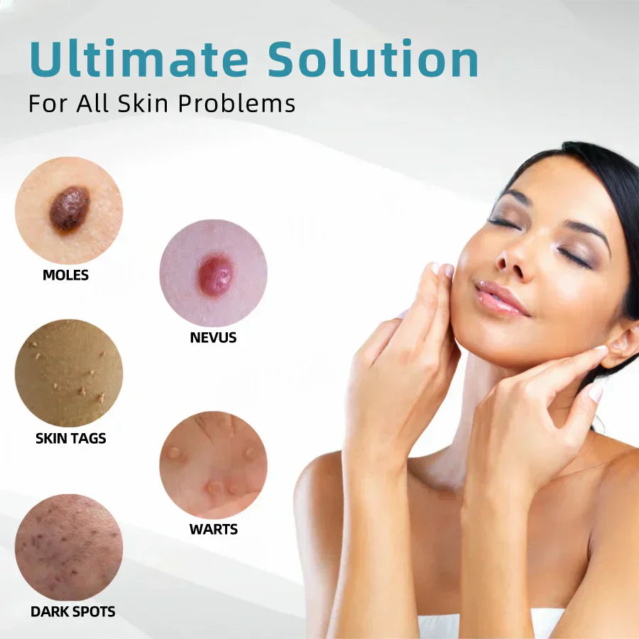 ✨Tiworld™ All-in-One CO₂ Laser Eraser Pen | Removes Moles, Warts, Skin Flaws & Pigmentation